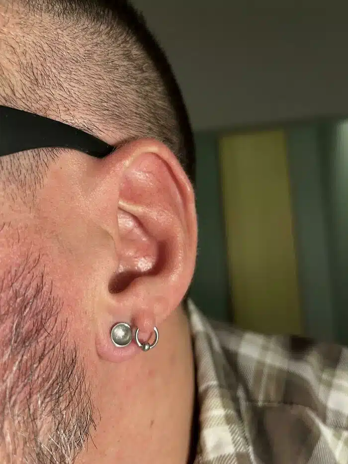 Extra Skin On Ear