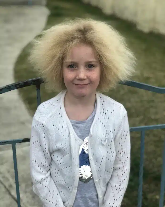 Hair Condition