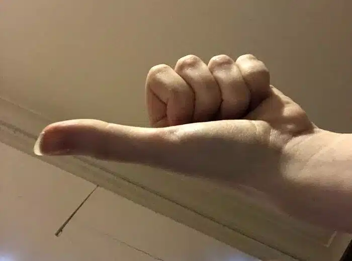 Long Thumbs