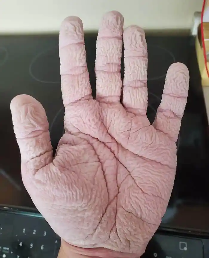 My Hands